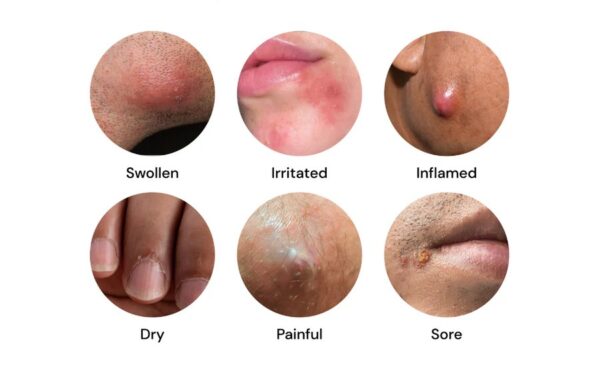 Derm Relief Balm - Image 3