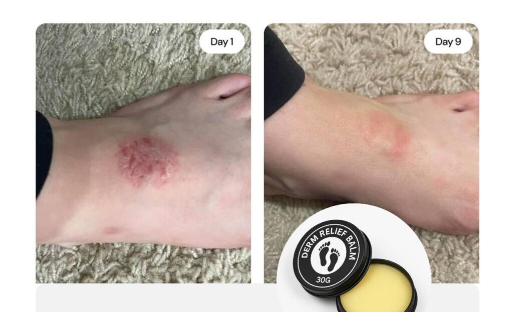 tentoes balm