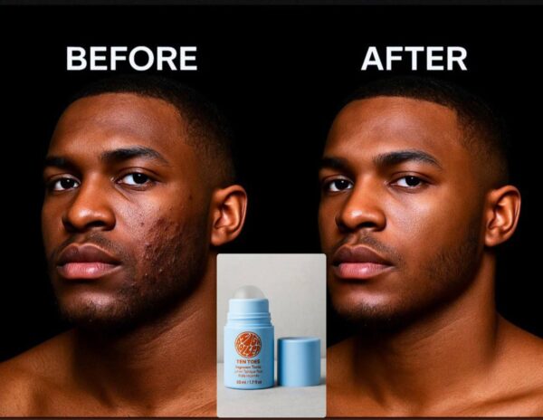 Ingrown Hair Serum Roller – Exfoliating Aftershave 50ml - Image 6