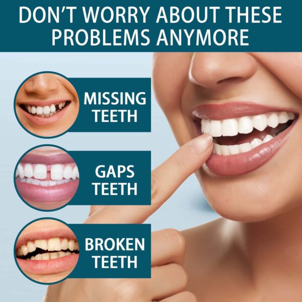 Snap-On Cosmetic Smile Covers (Non-Medical) - Image 3