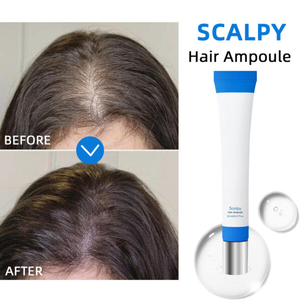 Scalpy Scalp Serum – Nourishing Scalp Care - Image 4