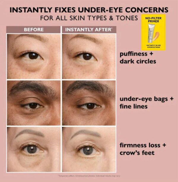 Instant Face Tightener Cream – Lift, Firm & Smooth Skin in Minutes | TenToes Skincare - Image 5
