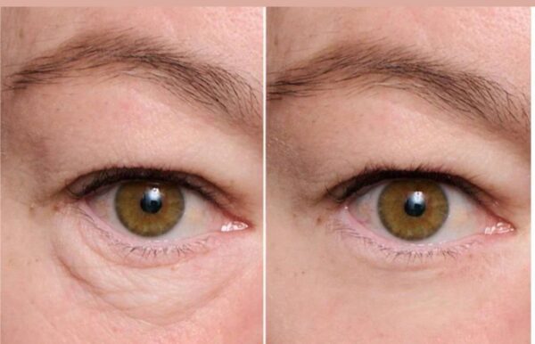 enToes Electric Eye Cream Massager for Dark Circles & Puffiness