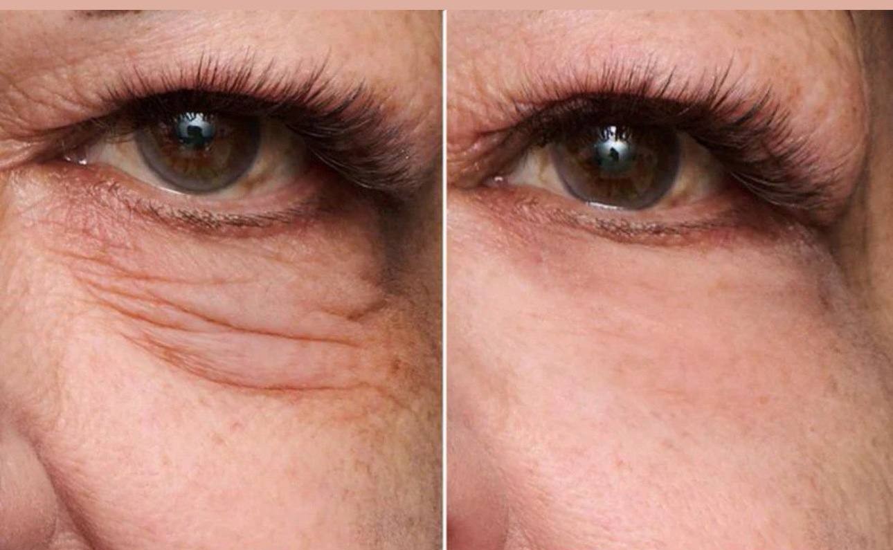 Electric Eye Cream Massager – Refresh & Depuff Look