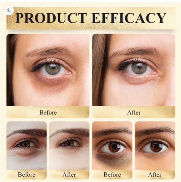 Eye Corrector SPF 41 – Dark Circle Concealer & Brightening Eye Cream - Image 2
