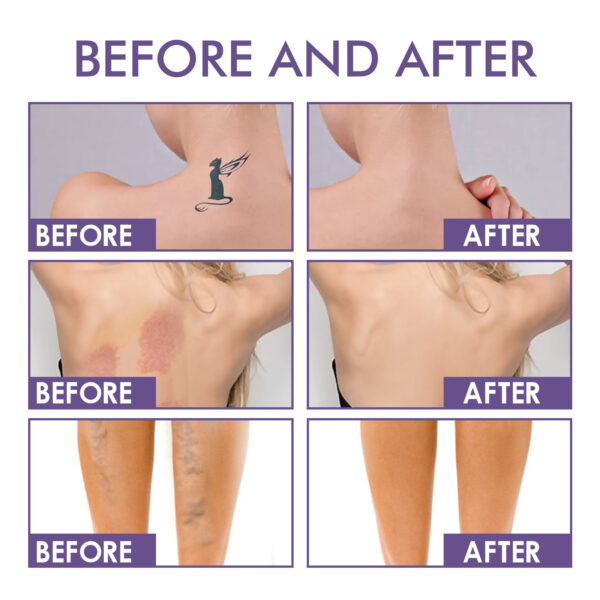 Body Coverage Perfector – Waterproof Full Coverage Cream for Flawless Skin 74ml | TenToes Hamburg - Image 2