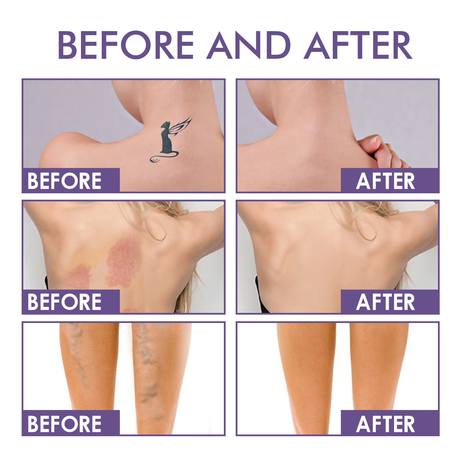 Body Coverage Perfector – Waterproof Full Coverage Cream for Flawless Skin 74ml | TenToes Hamburg